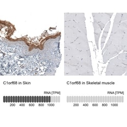 XP32 Antibody, Novus Biologicals:Antibodies:Primary Antibodies